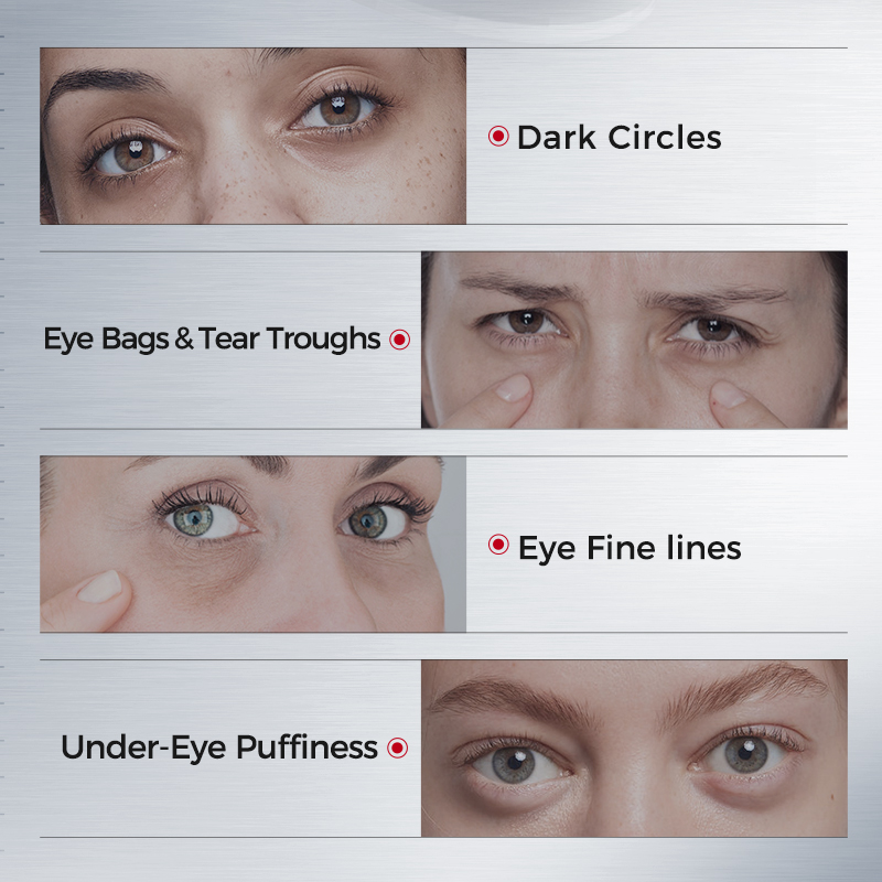 Oogpatches tegen donkere kring - Collagen Eye Patch recensie en prijs